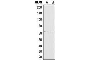 Western blot analysis of IL-20RA expression in A375 (A), MCF7 (B) whole cell lysates. (IL20RA 抗体  (Center))