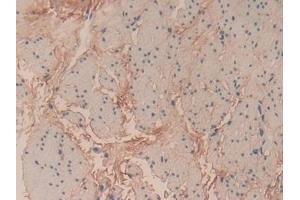 Immunohistochemistry (IHC) image for anti-Collagen, Type VI, alpha 3 (COL6a3) (AA 463-624) antibody (ABIN7434719)