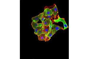 Immunocytochemistry (ICC) image for anti-TNF Receptor-Associated Factor 2 (TRAF2) (AA 39-188) antibody (ABIN5542488)