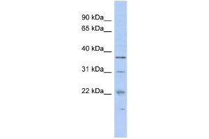 WB Suggested Anti-MCTS1 Antibody Titration:  0. (MCTS1 抗体  (N-Term))