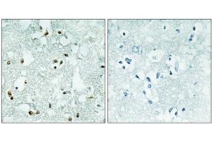 Immunohistochemistry analysis of paraffin-embedded human brain tissue, using ELAC2 antibody. (ELAC2 抗体  (Internal Region))