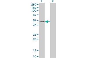 Western Blotting (WB) image for anti-Tribbles Homolog 3 (Drosophila) (TRIB3) (AA 56-145) antibody (ABIN566162)