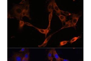 Immunofluorescence analysis of NIH/3T3 cells using HMGCR Polyclonal Antibody at dilution of 1:100. (HMGCR 抗体)