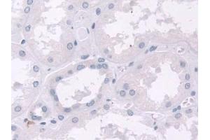 Detection of NELL2 in Human Kidney Tissue using Polyclonal Antibody to NEL Like Protein 2 (NELL2)