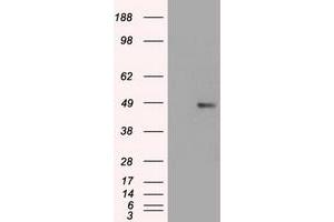 HEK293T cells were transfected with the pCMV6-ENTRY control (Left lane) or pCMV6-ENTRY FOXA1 (Right lane) cDNA for 48 hrs and lysed. (FOXA1 抗体  (AA 1-473))