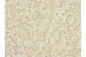 Immunohistochemistry (IHC) image for anti-Centromere Protein K (CENPK) (AA 1-269) antibody (ABIN7147366)