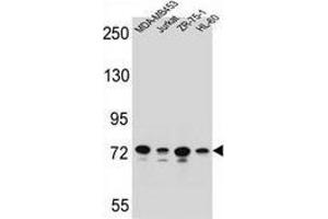 Western blot analysis in MDA-MB453,Jurkat,ZR-75-1,HL-60 cell line lysates (35ug/lane) using PCDHB15  Antibody (N-term).