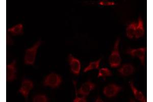 ABIN6274745 staining Hela by IF/ICC. (MRPL51 抗体  (C-Term))