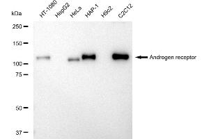 Western blotting analysis using Androgen receptor antibody (ABIN7797600). (Recombinant Androgen Receptor 抗体)