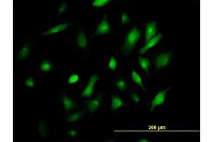 Immunofluorescence of purified MaxPab antibody to BST2 on HeLa cell. (BST2 抗体  (AA 1-180))