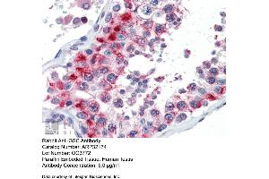Immunohistochemistry with Human Testis lysate tissue at an antibody concentration of 5. (GSC 抗体  (N-Term))