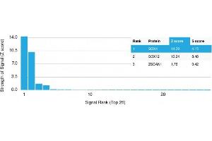 Analysis of Protein Array containing more than 19,000 full-length human proteins using SOX4 Mouse Monoclonal Antibody (SOX4/2540). (SOX4 抗体)