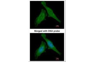 ICC/IF Image Immunofluorescence analysis of paraformaldehyde-fixed HeLa, using DDB1, antibody at 1:200 dilution. (DDB1 抗体  (C-Term))