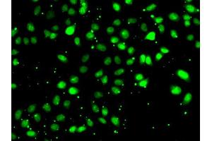 Immunofluorescence analysis of HeLa cell using NUDT2 antibody. (NUDT2 抗体)