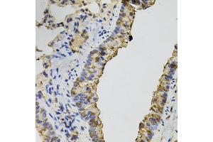 Immunohistochemistry of paraffin-embedded mouse lung using DNM2 antibody (ABIN5970189) (40x lens). (DNM2 抗体)