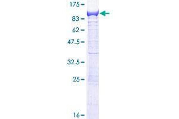 EFHC1 Protein (AA 1-640) (GST tag)