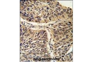 Immunohistochemistry (Paraffin-embedded Sections) (IHC (p)) image for anti-Chaperonin Containing TCP1, Subunit 3 (Gamma) (CCT3) (AA 509-536), (C-Term) antibody (ABIN389421)
