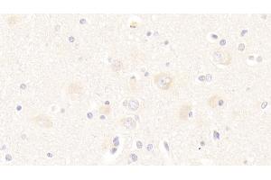 Immunohistochemistry (IHC) image for anti-Twisted Gastrulation Homolog 1 (TWSG1) (AA 26-223) antibody (ABIN7436153)