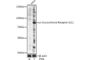 Western blot analysis of extracts of HeLa cells, using Phospho-Glucocorticoid Receptor-S211 antibody (ABIN6135269, ABIN6136160, ABIN6136161 and ABIN6225653) at 1:2000 dilution. (Glucocorticoid Receptor 抗体  (pSer211))