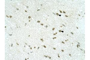 RNF168 antibody was used for immunohistochemistry at a concentration of 4-8 ug/ml to stain Neural cells (arrows) in Human Brain. (RNF168 抗体  (C-Term))