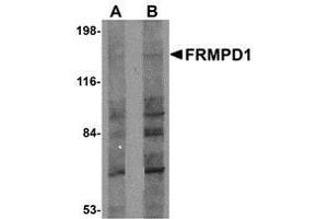 Western blot analysis of FRMPD1 in K562 cell lysate with AP30347PU-N FRMPD1 antibody at (A) 1 and (B) 2 μg/ml. (FRMPD1 抗体  (C-Term))