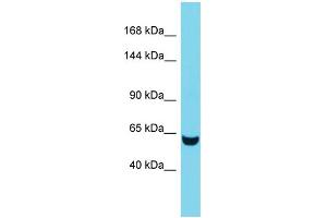 Western Blotting (WB) image for anti-Tensin 3 (TNS3) (C-Term) antibody (ABIN2790595) (TNS3 抗体  (C-Term))