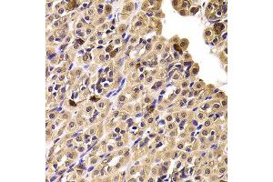 Immunohistochemistry of paraffin-embedded Rat stomach using CCT4 antibody at dilution of 1:100 (x400 lens). (CCT4 抗体)