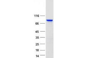 Validation with Western Blot