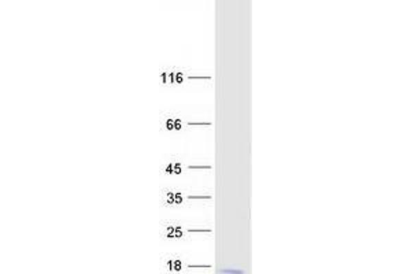 ZNF706 Protein (Transcript Variant 2) (Myc-DYKDDDDK Tag)