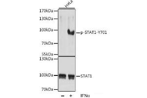 Western blot analysis of extracts of HeLa cells using Phospho-STAT1(Y701) Polyclonal Antibody at dilution of 1:1000.