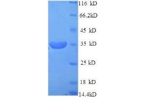 SDS-PAGE (SDS) image for N-Methylpurine-DNA Glycosylase (MPG) (AA 13-298), (partial) protein (His tag) (ABIN5713660) (MPG Protein (AA 13-298, partial) (His tag))