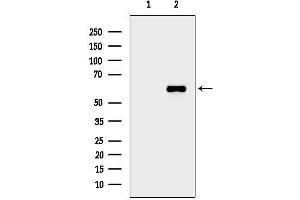 anti-Calcium/calmodulin-Dependent Protein Kinase IV (CAMK4) (pThr200) antibody