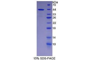 SDS-PAGE analysis of Human NFkB2 Protein. (Nuclear Factor kappa B2 蛋白)