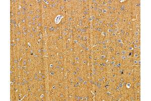 ABIN7095870 and ABIN7099932 at 1/100 staining rat brain tissue by IHC-P. (PARP16 抗体)