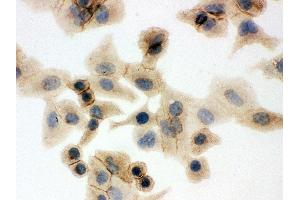 Anti- SLC2A1 Picoband antibody, ICC ICC: A549 Cell (GLUT1 抗体  (AA 92-492))