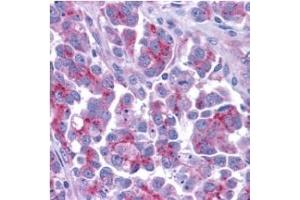 Smac/DIABLO â€“ ABIN121595 staining of human ovary tissue with anti-Smac/DIABLO (CT) at 5 (DIABLO 抗体  (AA 225-239))