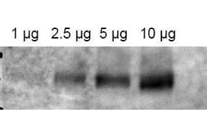 Image no. 1 for anti-ATP-Binding Cassette, Sub-Family B (MDR/TAP), Member 1 (ABCB1) (AA 262-277) antibody (ABIN401371) (ABCB1 抗体  (AA 262-277))