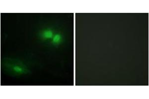 Immunofluorescence analysis of HeLa cells, using DAXX Antibody. (DAXX 抗体  (AA 361-410))