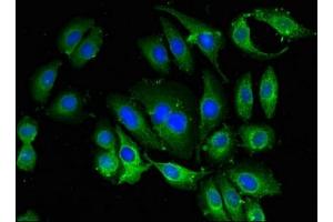 Immunofluorescent analysis of A549 cells using ABIN7145258 at dilution of 1:100 and Alexa Fluor 488-congugated AffiniPure Goat Anti-Rabbit IgG(H+L) (BANF1 抗体  (AA 2-89))