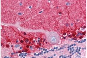 Human Brain, Cerebellum (formalin-fixed, paraffin-embedded) stained with AMPH antibody ABIN351482 at 2. (Amphiphysin 抗体  (AA 159-170))