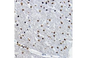 Immunohistochemistry of paraffin-embedded rat brain using SOX10 Rabbit pAb (ABIN6134484, ABIN6148289 and ABIN7101829) at dilution of 1:100 (40x lens). (SOX10 抗体)