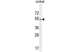 Western Blotting (WB) image for anti-Membrane Protein, Palmitoylated 1, 55kDa (MPP1) (AA 304-331), (Middle Region) antibody (ABIN953491)