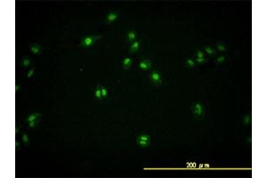 Immunofluorescence of monoclonal antibody to TARDBP on HeLa cell.