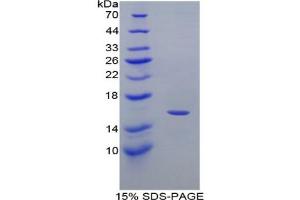 SDS-PAGE analysis of Mouse MIg Protein. (CXCL9 蛋白)