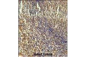 MEF2A Antibody (Center) (ABIN653206 and ABIN2842748) immunohistochemistry analysis in formalin fixed and paraffin embedded human tonsil tissue followed by peroxidase conjugation of the secondary antibody and DAB staining. (MEF2A 抗体  (AA 453-479))