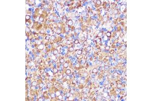 Immunohistochemistry of paraffin-embedded Rat ovary using NEK9 antibody (ABIN7268914) at dilution of 1:100 (40x lens). (NEK9 抗体  (AA 730-979))