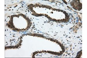 Immunohistochemical staining of paraffin-embedded Human pancreas tissue using anti-PDE4A mouse monoclonal antibody. (PDE4A 抗体)