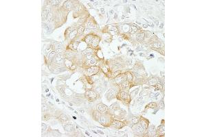 anti-Notch 2 (NOTCH2) (AA 2250-2300) antibody