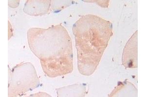 Immunohistochemistry (IHC) image for anti-Adiponectin (ADIPOQ) (AA 111-244) antibody (ABIN7432169)