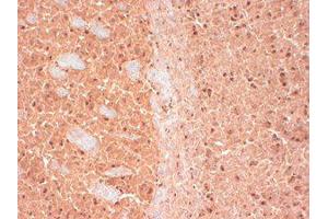 CASK Immunohistochemistry. (CASK 抗体)